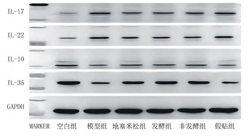 空白組和支氣管哮喘各組大鼠肺組織中IL－17、IL－22、IL－10、IL－35蛋白表達電泳圖